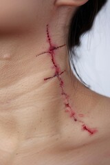 Poster - Close up of a person with a visible wound on their neck. Suitable for medical or injury-related concepts