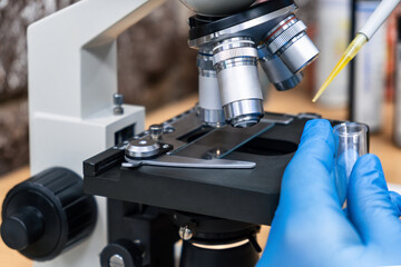 doctor dripping urine from a pipette onto glass under microscope to check for urolithiasis disease. 