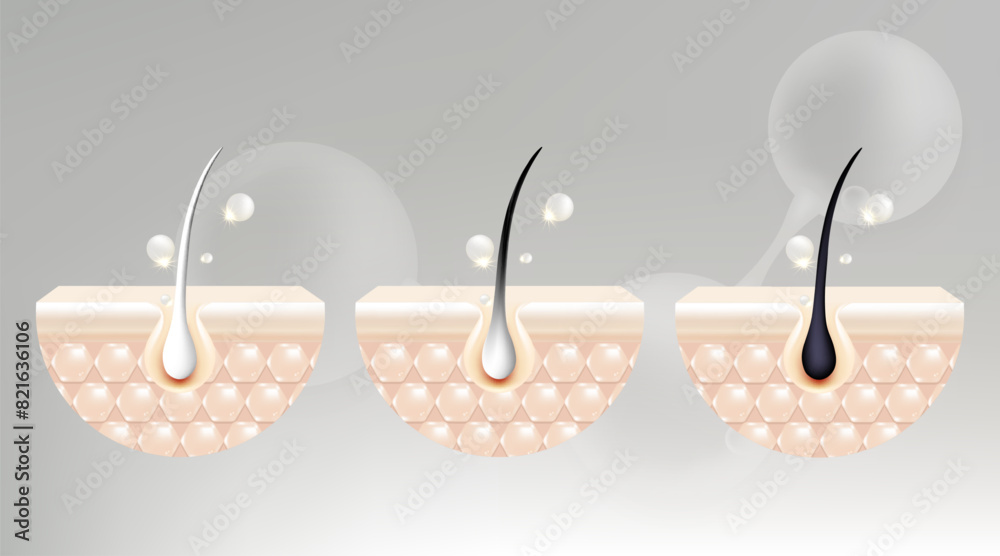 Hyaluronic acid and Niacinamide before and after gray hair and skin solutions ad, white collagen