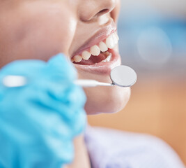 Canvas Print - Woman, mirror and dental hygiene at dentist for teeth checkup by cleaning, whitening and gum treatment. Mouth, patient and medical examination of gingivitis, orthodontist or veneer results at clinic