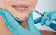 © peopleimages.com - Cosmetic, injection and woman with smile of dermal filler for beauty transformation, treatment or pride. Studio, patient and needle on grey background for plastic surgery, dermatology or lip plump