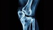 © Fay Melronna  - A clinical Xray image depicting the knee joint, showing bone structure and ligament arrangement for medical analysis and assessment