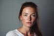 © sorin - Hormonal acne transformation  before after photos of woman with clear skin after treatment