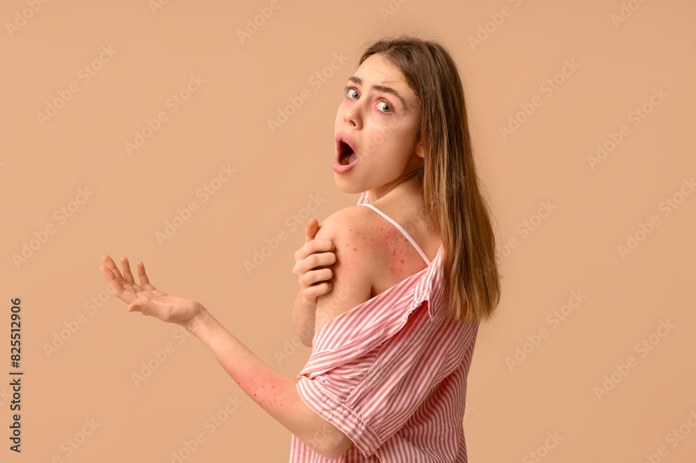 Young woman with skin allergy on brown background