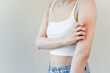 © Pormezz - Sensitive skin allergic concept, Woman itching on her arm have a red rash from allergy symptom and from scratching.