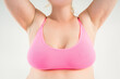 © staras - Large natural saggy breasts with asymmetry after breastfeeding, big boobs with stretch, marks, augmentation and plastic surgery concept