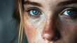 © EmmaStock - A close-up of captivating blue eyes and freckles