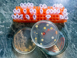 Sticker - Petri dishes with colonies of bacteria and a pencil case with Eppendorfs nearby.