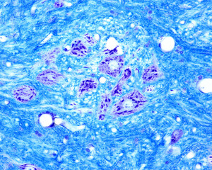 Sticker - Spinal cord. Ventral horn. Motor neurons