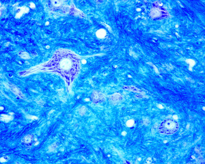 Poster - Spinal cord. Ventral horn. Motor neurons