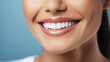 © Paul Peery - Radiant Woman's Smile Highlighting White Teeth