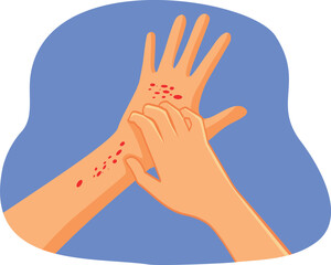 Wall Mural - Hands Scratching Having Eczema Problems Vector Illustration. Person feeling itchy suffering from topic skin condition
