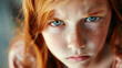 © Keitma - Portrait of an unhappy young ginger girl kid