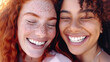© sommersby - Close-up portrait of two young women with bright, white smiles. The woman on the left has red hair and freckles, while the woman on the right has curly, dark hair.