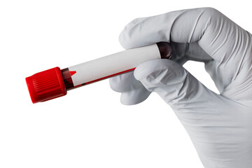 Wall Mural - doctor holding a blood test tube during coronavirus pandemic transparent png