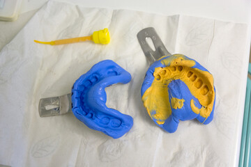 Real shot of dental impressions for upper and lower jaw dentures, made of blue silicone.