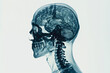 © GODSTOX - a x-ray of a man's head