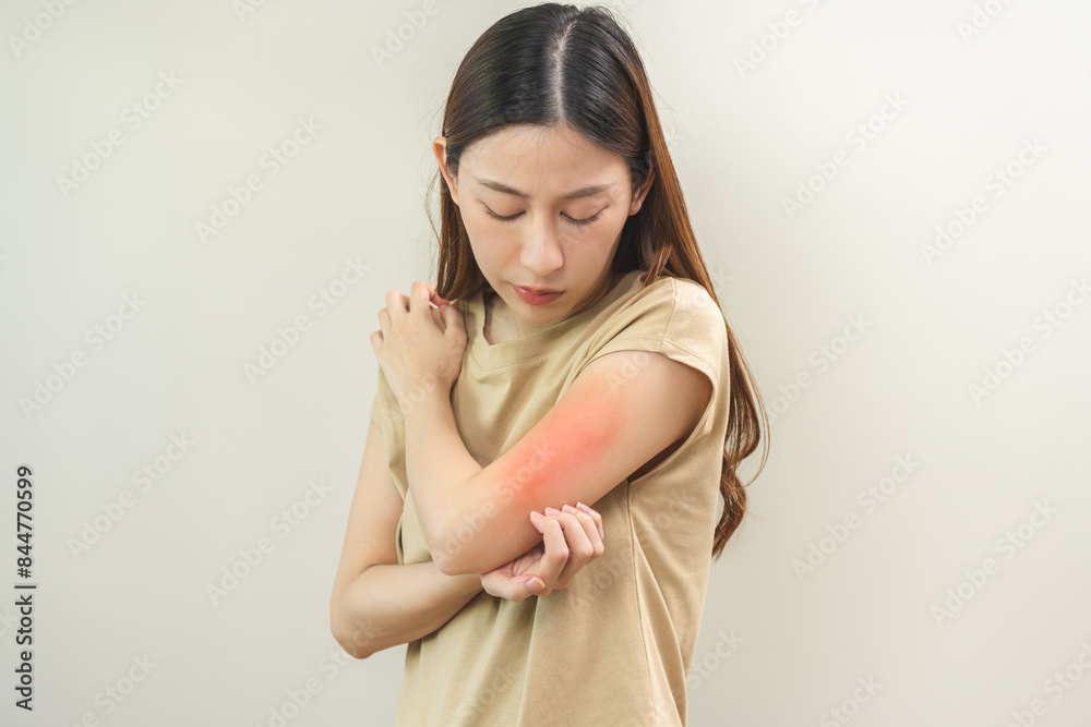Scratching Reaction Dermatology asian young woman, girl allergy, allergic reaction from ...