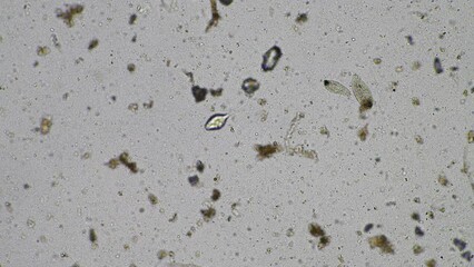 Wall Mural - soil microorganisms under a microscope including amoeba, flagellates, nematodes, fungi, bacteria, from a soil sample on a regenerative agriculture farm in Australia