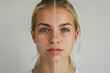 © Sergio - A close-up of a young womans face, divided into two sections. The left side shows her face with visible acne scars, while the right side shows clear, smooth skin