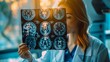 © Abda - woman doctor holding MRI film to diagnosis injury area of brain with double exposure of brain CT scan
