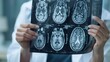 © Abda - woman doctor holding MRI film to diagnosis injury area of brain with double exposure of brain CT scan