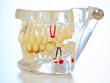 © peopleimages.com - Teeth model, healthcare and dentist on table for dental education, tooth whitening and oral care. Dentistry, patient awareness and orthodontist with tool for mouth hygiene, dentures or gum inspection