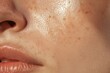 © Jeannaa - Close-up of a woman's face focuses on skin texture and freckles, highlighting natural beauty and realistic complexion details.