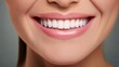 © Xyeppup - Dental treatment success, radiant smile, professional backdrop, high detail
