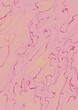 © Brown - fond marbré rose pour web