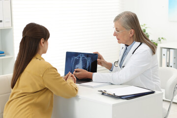 Wall Mural - Lung cancer. Doctor showing chest x-ray on laptop to her patient in clinic