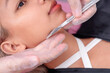 © Mdv Edwards - Close-up of dermaplaning or microplaning procedure to closely shave and exfoliating the skin.