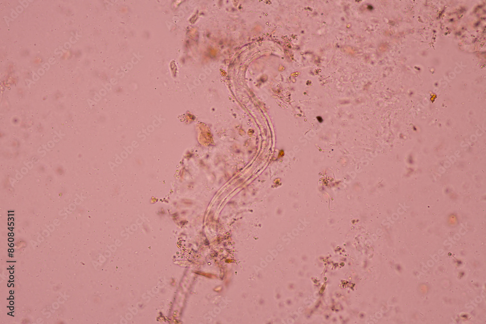 View in microscopic Strongyloides stercoralis or threadworm in human