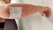 © Rung Kh - portrait showing the accident and have a wounds injured on the body, Bruise and Bandage on the elbow and arm, health care and medical concept.