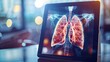 © Otseira - transparent tablet display showing respiratory syndrome (lung)