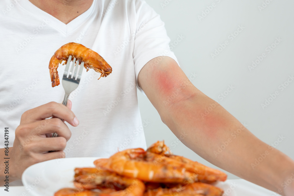 food allergies, men have reactions itching and redness after eating ...
