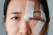 © TripleP Studio - Asian woman's covered eye with plastic clear shields protective irritation and wounds to cornea, causing eye to become swollen and red. eye become inflamed. Ophthalmologist treats eye infections.