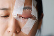 © TripleP Studio - Asian woman's covered eye with plastic clear shields protective irritation and wounds to cornea, causing eye to become swollen and red. eye become inflamed. Ophthalmologist treats eye infections.