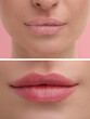 © New Africa - Permanent makeup. Collage with photos of woman before and after lip blushing, closeup