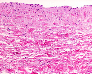 Poster - Vein wall layers