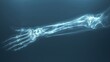 © pengedarseni - Human hand X-ray image