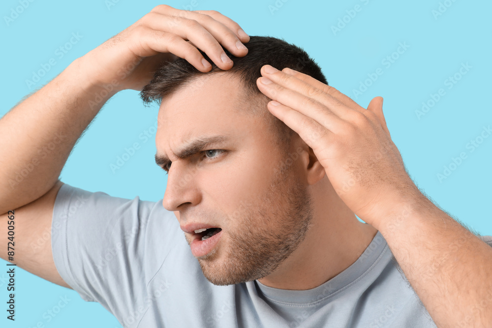 Shocked young man with hair loss problem on blue background, closeup