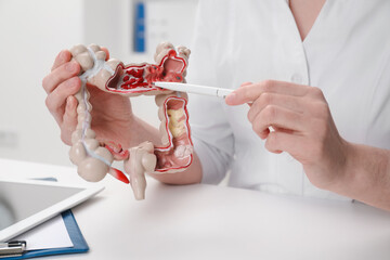 Wall Mural - Doctor showing model of large intestine at white table in clinic, closeup