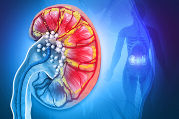 Wall Mural - Remove kidney stones. 3d illustration