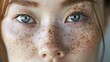 © vefimov - Close-up portrait of a woman with distinctive freckles on her face