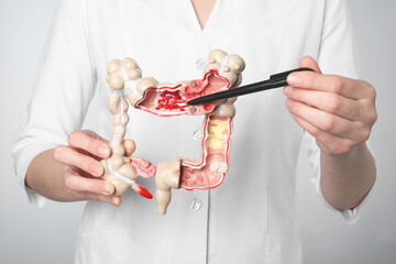 Wall Mural - Doctor showing model of large intestine on light grey background, closeup