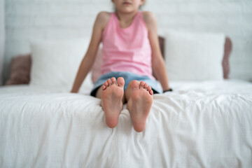 children's foot closeup, corns and calluses on feet, dry skin on legs, cracked heels, barefoot girl 