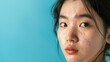 © Kanchanit - Close-up of a South Korean woman with acne scars
