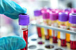 © Renata Hamuda - close up of scientist hand holding test tube with blood sample making research in clinical laboratory