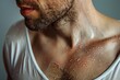 © Сергей Косилко - Close-up of a man with excessive sweating
